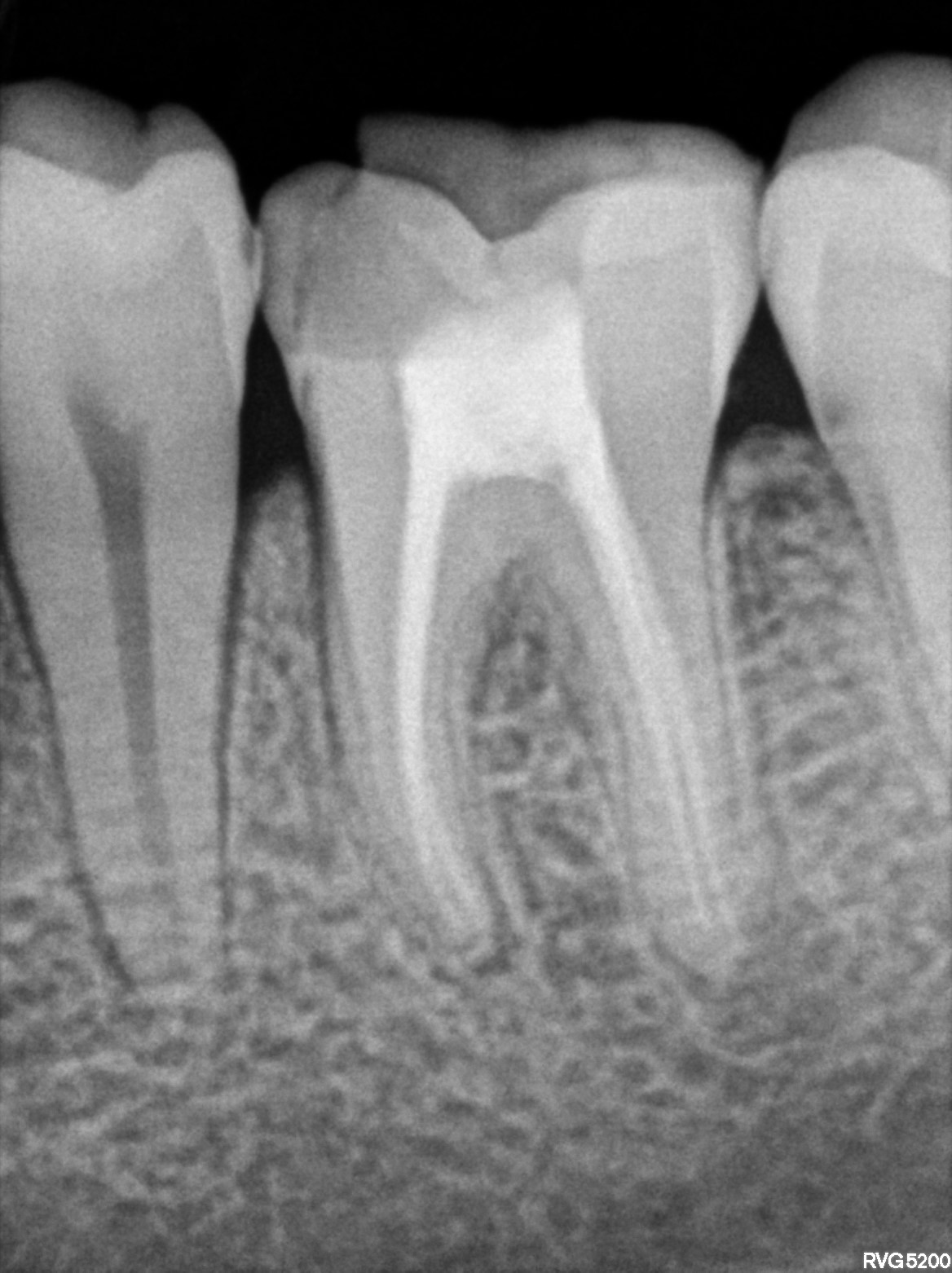 Dental X-ray